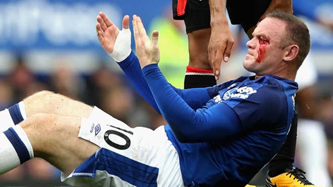 SỐC trước khuôn mặt của Rooney đầm đìa máu vì bị đánh cùi chỏ