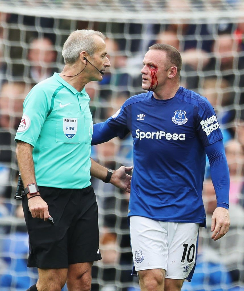 Dù vậy, trọng tài Atkinson lại không rút thẻ phạt nào với Francis. Rooney đã rất tức giận. Thậm chí, khi ở ngoài để chăm sóc vết thương, Rooney cũng liên tục nói lớn với trọng tài biên gần đó.