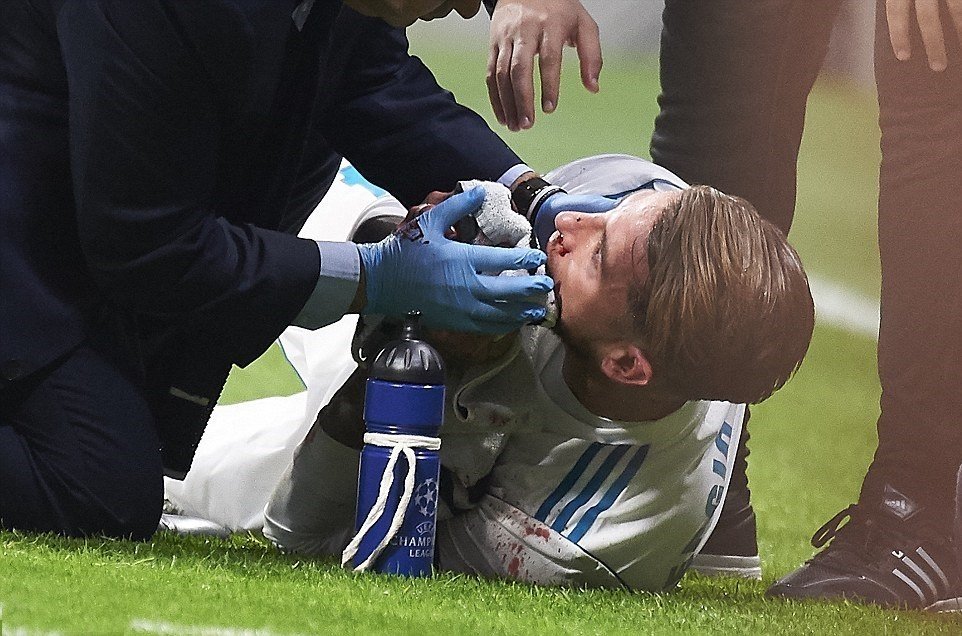  Chấn thương của Ramos.