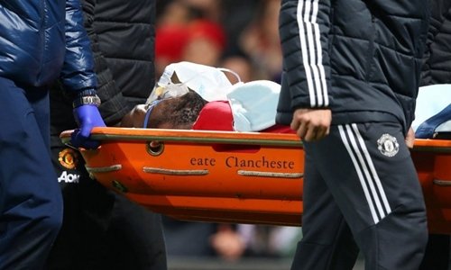 Lukaku không bị chấn thương nặng. 