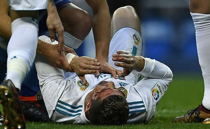 Thay cho một màn chia vui sau bàn thắng, Ronaldo nằm xuống ôm mặt với máu chảy từ vết thương