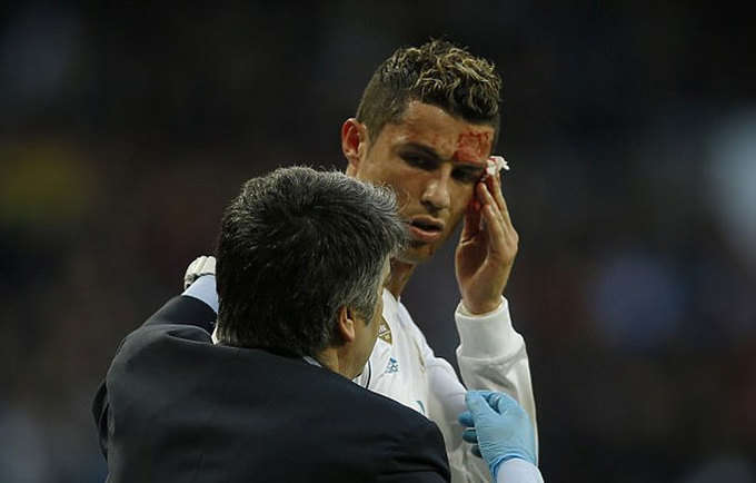 Ngôi sao mang áo số 7 sau đó đứng dậy rời sân cùng một bác sĩ. Vết rách trên mặt khiến Ronaldo không thể thi đấu tiếp